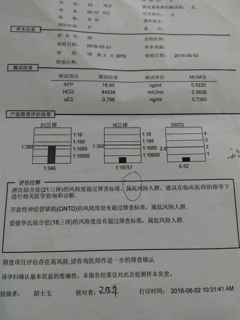 33岁怀二胎唐氏筛查高风险-33岁做唐氏筛查一定是高风险吗