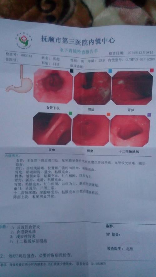 做了胃镜手术能喝蜂蜜水吗-肠镜8小时前可以喝蜂蜜水吗