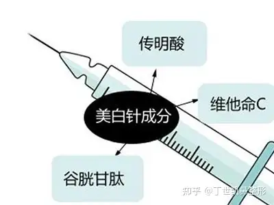 打美白针可以抗过敏吗-打美白针可以抗过敏吗知乎